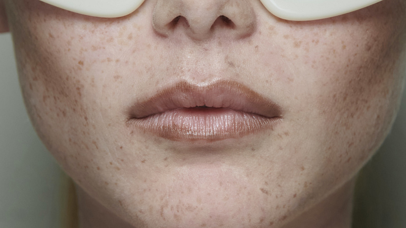 #Sunkissed: Proč jsou všichni posedlí pihami a jak si je vytvořit